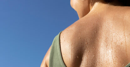 Woman in a green vest top, with a sweaty back on a blue background. 7 reasons your might be sweating too much.