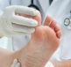 A doctor examining a Nail Fungal Infection