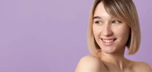 A girl with some acne on her face smiling on a purple background