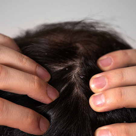 Itchy Scalp Condition Image FAQ