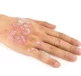 Pustular Psoriasis on the back of a persons hand