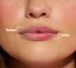 Before and after effects of Dermal Therapy Pink Lip Tint, adding a soft rosy tint with deep hydration.