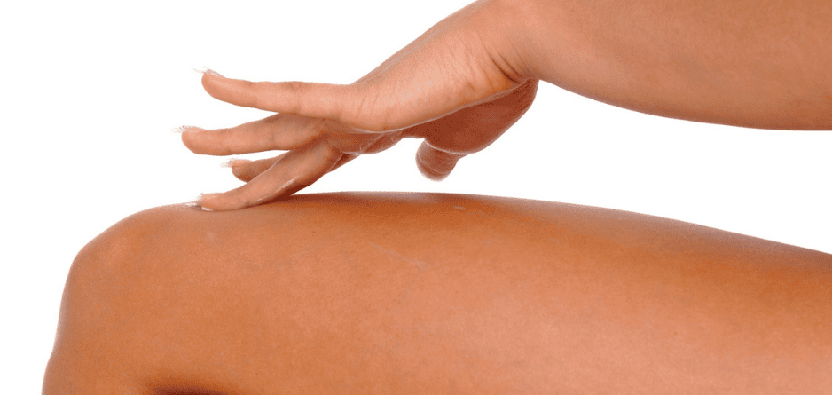 Jock Itch: Why It Happens and How to Manage It