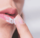 A person applying Cold Sore cream to their lip - thinking about The Role of Lysine in Cold Sore Treatment