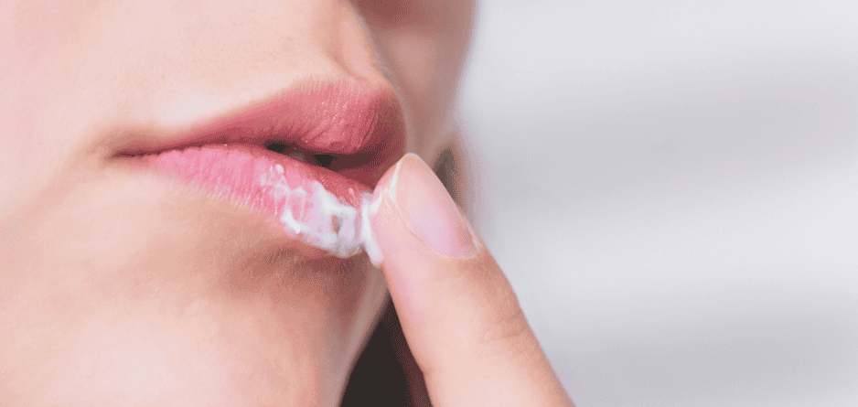 A person applying Cold Sore cream to their lip - thinking about The Role of Lysine in Cold Sore Treatment