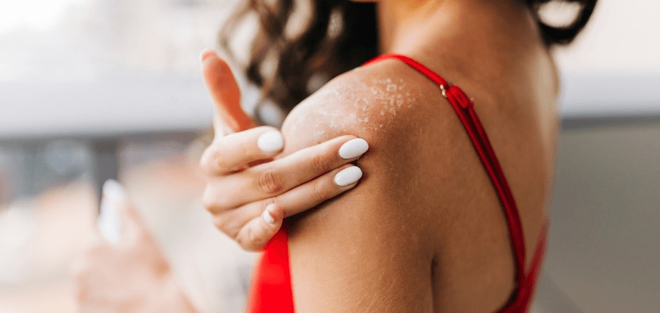 Why Diabetes Causes Dry Skin